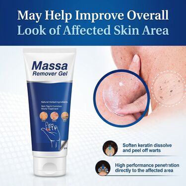 Massa Remover Gel (BCMR).